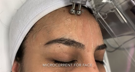 MicroCurrent Facial Package Photo